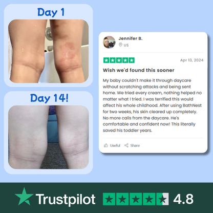 BathNest™ Children Bath Filter